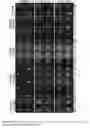Fig. 20 - Parylene-C Stencils