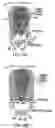 Fig. 10 - Reliant thermal barrier coating system and related methods and apparatus of making the same