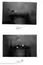 Fig. 08 - Therapeutic tool and method for use thereof