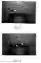 Fig. 09 - Therapeutic tool and method for use thereof