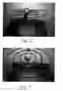 Fig. 11 - Therapeutic tool and method for use thereof