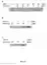 Fig. 06 - Antigen of Dengue Virus Type 1