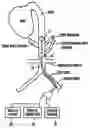 Fig. 01 - System and method for rapidly cooling cardiac arrest patient