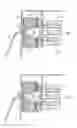 Fig. 02 - Appliance for water-jet surgery