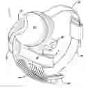 Fig. 01 - Flexible circuit electrode array with a drum stress relief