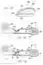 Fig. 22 - Flexible circuit electrode array with a drum stress relief