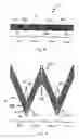 Fig. 03 - Vascular prosthesis with alternating helical sections