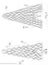 Fig. 06 - Vascular prosthesis with alternating helical sections