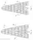 Fig. 07 - Vascular prosthesis with alternating helical sections