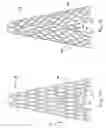 Fig. 08 - Vascular prosthesis with alternating helical sections