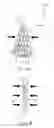 Fig. 10 - Vascular prosthesis with alternating helical sections