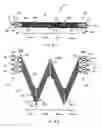 Fig. 17 - Vascular prosthesis with alternating helical sections