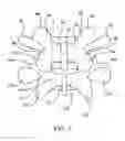 Fig. 02 - Systems and methods for posterior dynamic stabilization of the spine