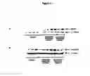 Fig. 131 - Expression profile of prostate cancer