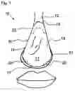 Fig. 02 - Nose guard mask