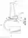 Fig. 02 - Pressure support respiration mask