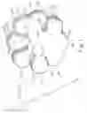 Fig. 02 - HAND AND FINGER HOLDING DEVICE FOR DISABLED HANDS