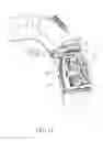 Fig. 15 - Foldable frame with detachable infant carrier