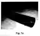 Fig. 11 - Torch