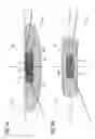 Fig. 06 - Headlamp having selectable beam