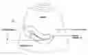 Fig. 01 - Sonography guided embryo transfer for in vitro fertilization