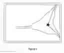 Fig. 06 - Sonography guided embryo transfer for in vitro fertilization