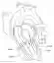 Fig. 01 - MITRAL VALVE REPAIR SYSTEM AND METHOD FOR USE