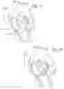 Fig. 22 - MITRAL VALVE REPAIR SYSTEM AND METHOD FOR USE