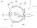 Fig. 01 - Eye module