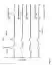 Fig. 02 - Wear resistant hard coating for a workpiece and method for producing the same