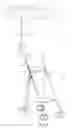 Fig. 02 - Umbrella attachment device