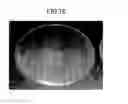 Fig. 11 - Electrical-discharge surface-treatment method