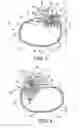 Fig. 06 - METHODS AND APPARATUS FOR PATIENT NOTIFICATION OF PHYSIOLOGIC EVENTS AND DEVICE FUNCTION