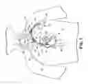 Fig. 02 - Systems and methods for transvenous lead implantation