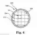 Fig. 07 - Systems and methods for transvenous lead implantation