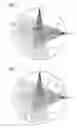 Fig. 03 - Method for scattered radiation correction in x-ray imaging devices