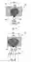 Fig. 07 - X-ray tomosynthesis device