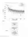 Fig. 05 - Simulation of Acoustic Obstruction and Occlusion
