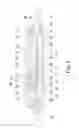 Fig. 04 - Microphone
