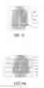 Fig. 11 - Method and apparatus for two-dimensional finger motion tracking and control