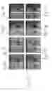 Fig. 06 - Methods for obtaining MRI frequency maps