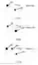 Fig. 12 - Two stage detection for photographic eye artifacts
