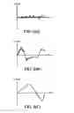 Fig. 03 - Method and apparatus for image stabilization