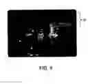 Fig. 05 - Coordinating Audio/Video Items Stored On Devices