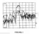 Fig. 02 - Nondestructive methods for testing the degree of hardening or drying of inks and coatings