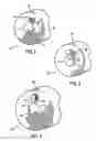 Fig. 02 - Non-marring shaft collar
