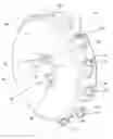 Fig. 01 - Method of pumping gaseous matter via a supersonic centrifugal pump