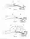 Fig. 04 - Rotor blade for a wind turbine having a variable dimension