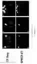 Fig. 03 - METHODS OF IMAGING EMPLOYING CHELATING AGENTS