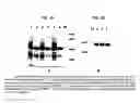Fig. 05 - Anti-PRL-3 antibodies and methods of use thereof
